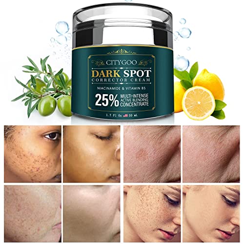 CITYGOO Dark Spot Remover for Face: Dark Spot Corrector Cream - Natural Ingredient,Enriching Skin Care For All Skin Tones - Melasma, Freckle, Sun Spot Remover & Blemish Reducer-1.7 FL OZ